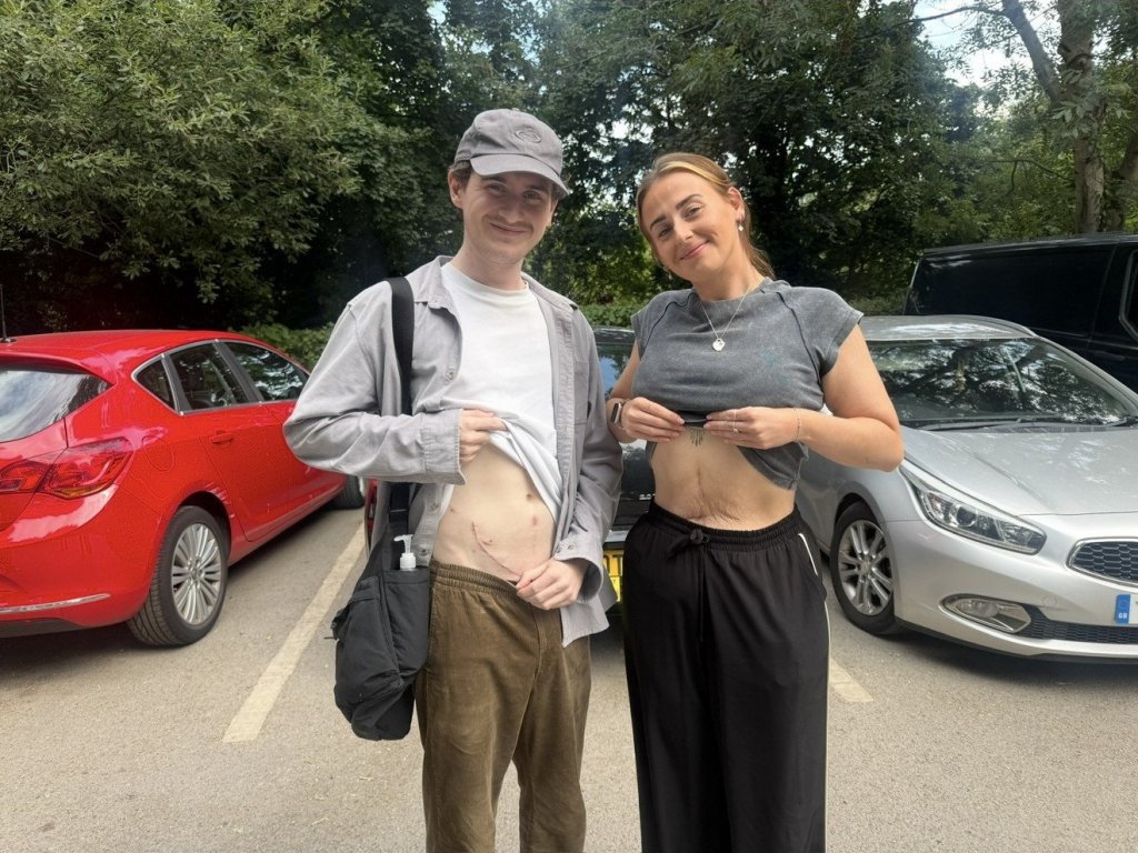 Rachel and Harry Ware show their scars in a photo released on Tuesday, Sept. 29, 2026.